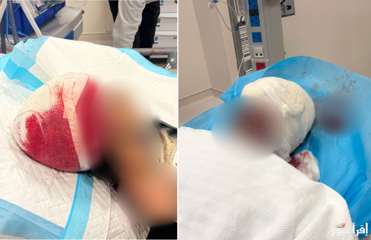 شاب قطري يتعرض لهجوم اسد في منزل أحد أصدقائه تسبب في خضوعة لعملية جراحية 4 ساعات